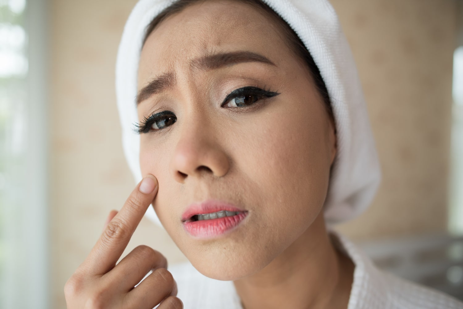 mulher com toalha na cabeça apontando para acne no rosto